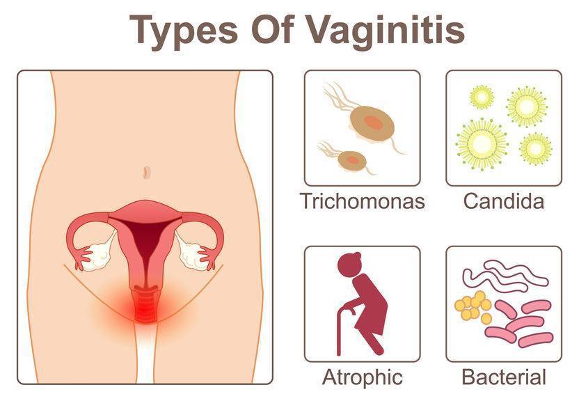 10кӾθȾHPV 10кӾ,ŵ׳С,ȾHPV!