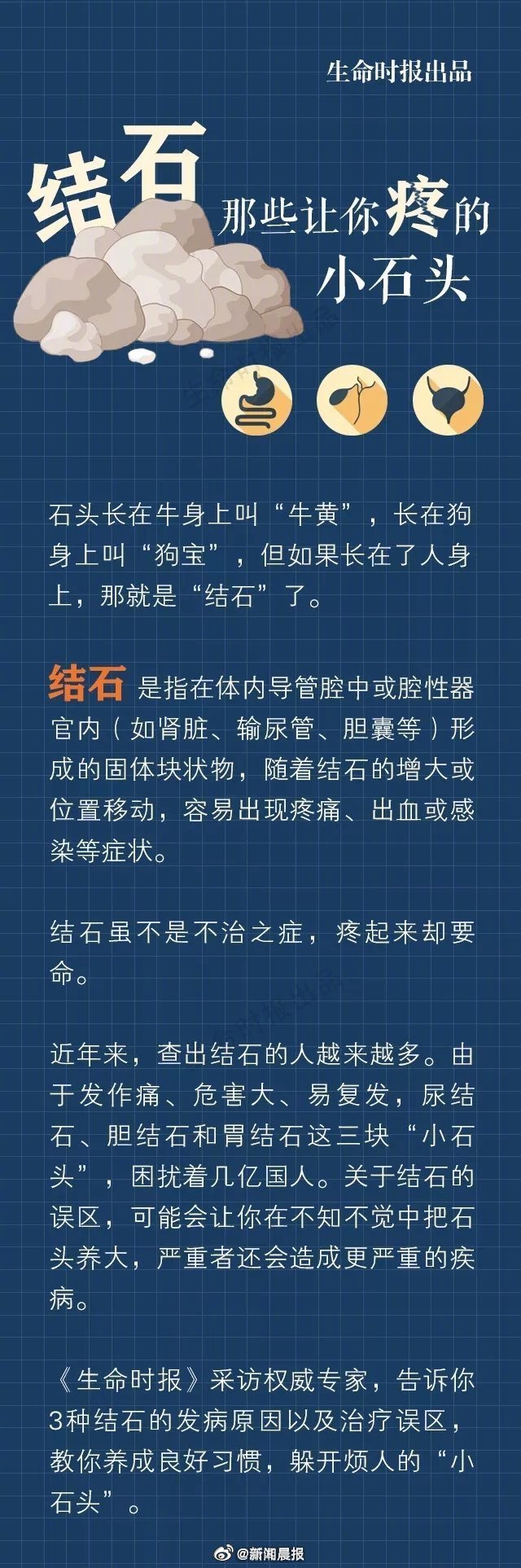 尿结石是怎么引起的图片