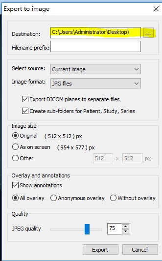 MicroDicom viewer(Dicomʽͼ)