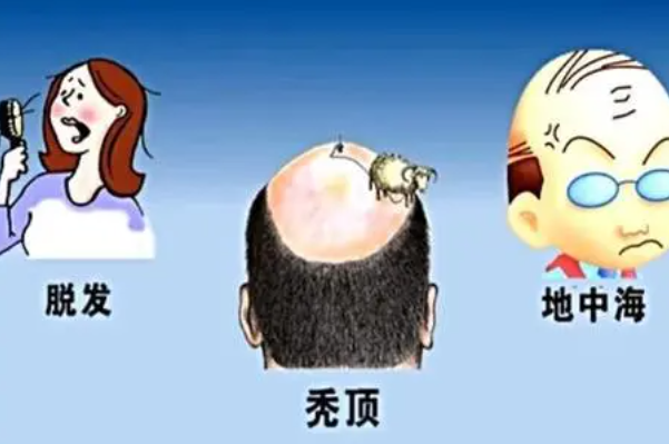 ֲԼǮ?3000Ԫ15000Ԫ()