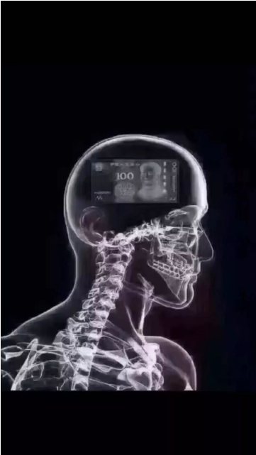 CTͼƬʲô  ܻCTͼƬ