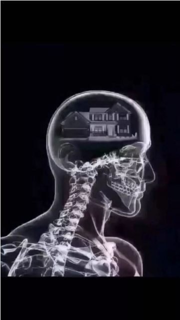 CTͼƬʲô  ܻCTͼƬ