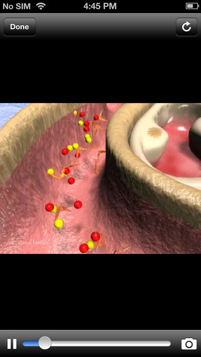 Animated Atlas of Diabetes