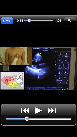 One Minute Ultrasound