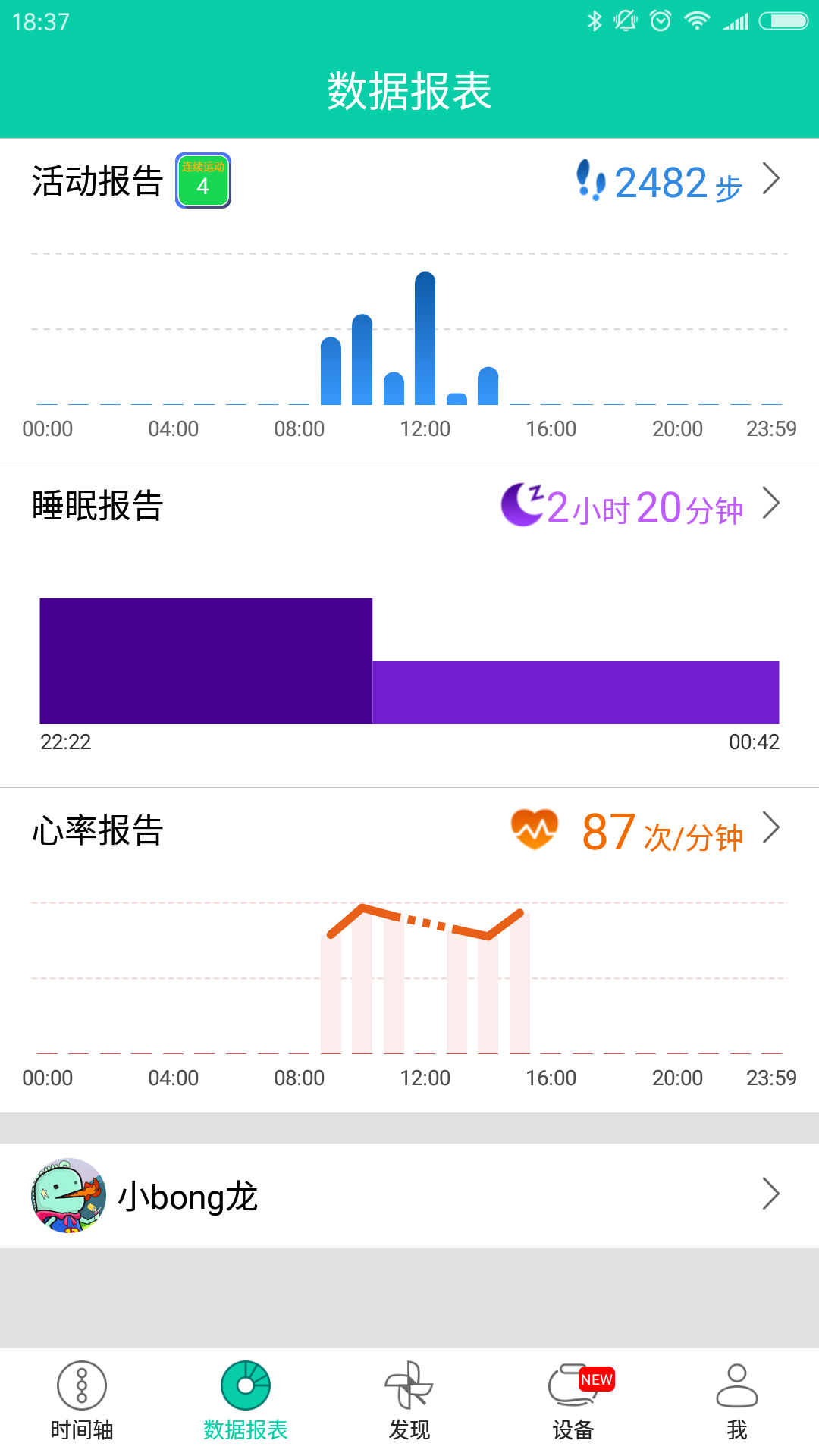 bongͼ1